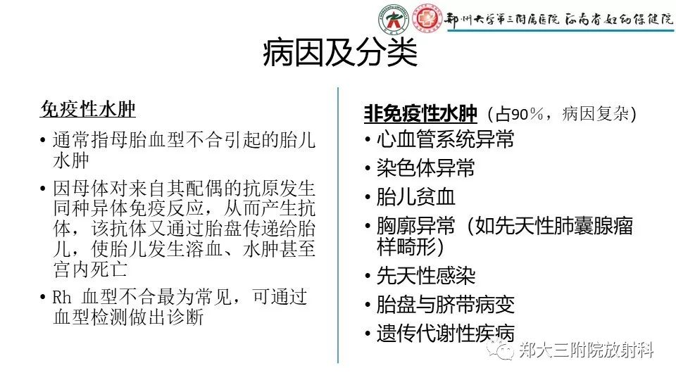 【PPT】胎儿水肿综合征
