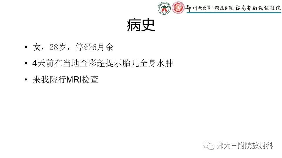 【PPT】胎儿水肿综合征