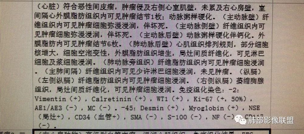 【病例】心包恶性间皮瘤1例CT影像