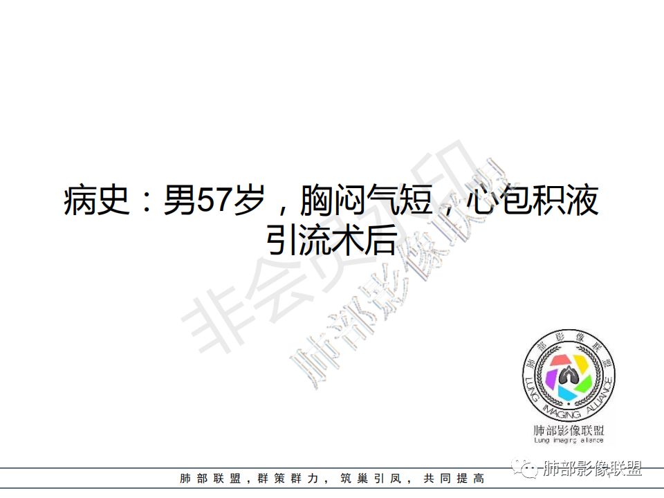 【病例】心包恶性间皮瘤1例CT影像