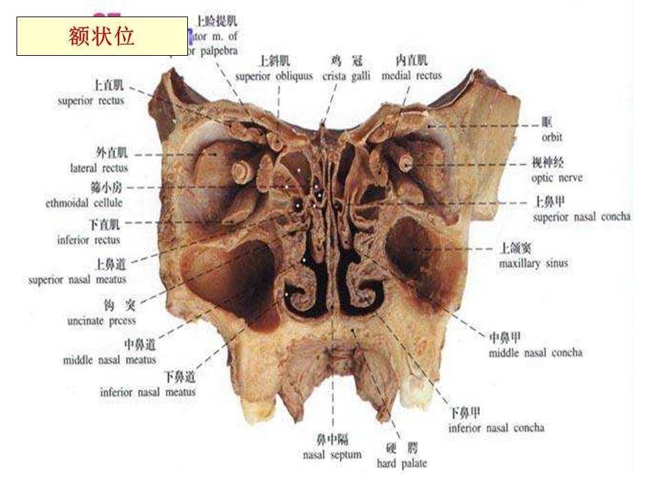 幻灯片17