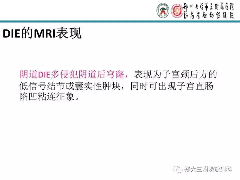 【病例】一例有内膜癌的子宫腺肌症MR