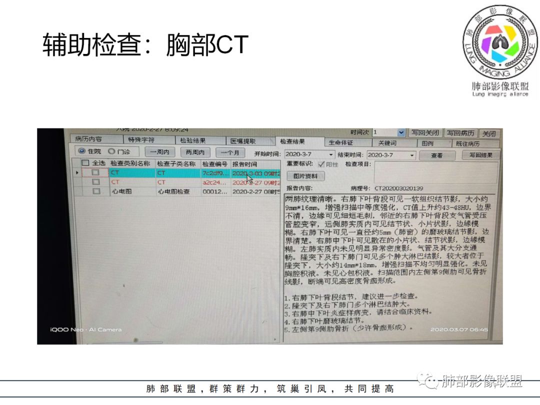 【病例】结核居然也能有晕征 【病例】结核居然也能有晕征