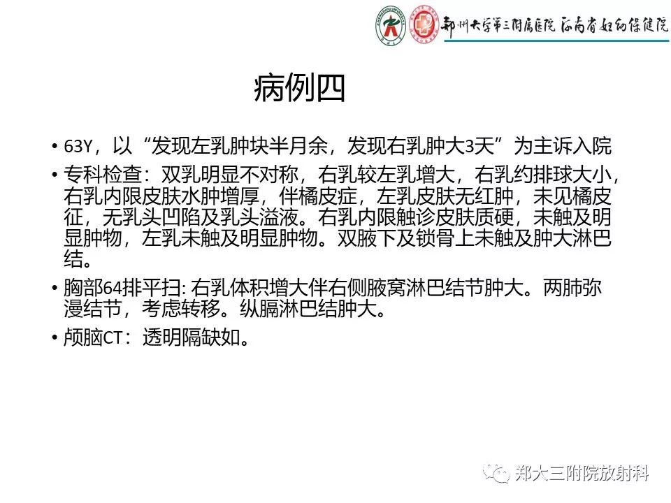 【PPT】非哺乳期乳腺炎症与炎性乳癌的影像鉴别诊断