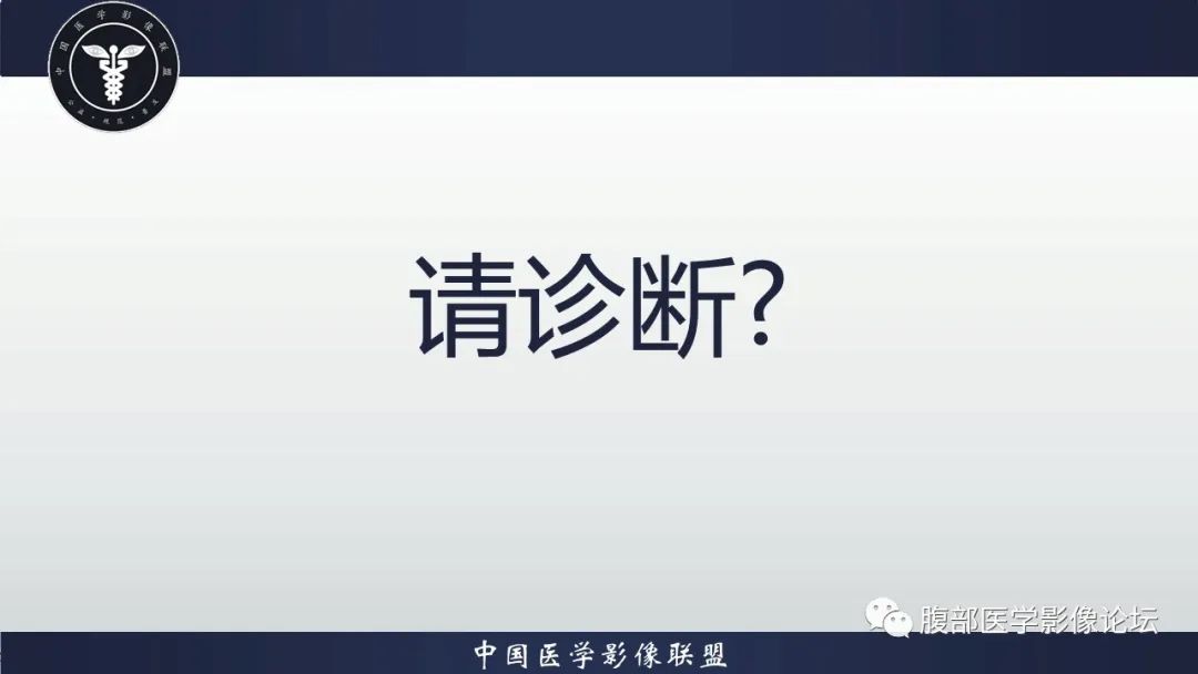 【病例】盆腔囊性成熟性畸胎瘤1例MR