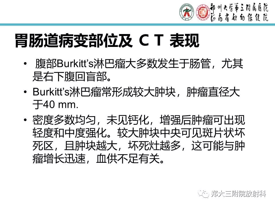 【PPT】小儿腹部伯基特Burkitt's淋巴瘤