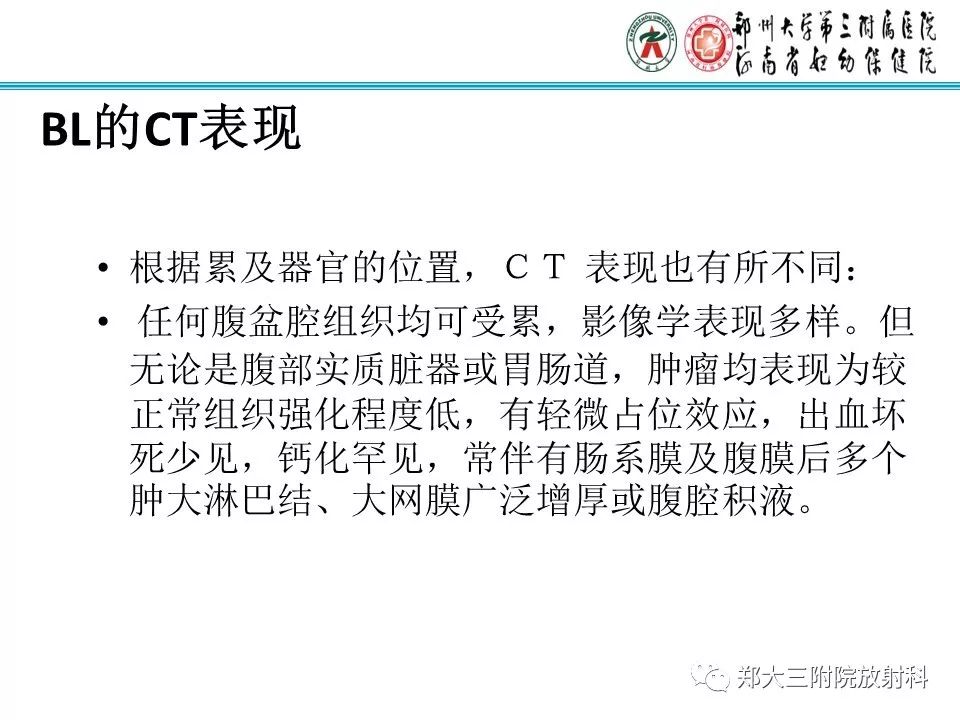 【PPT】小儿腹部伯基特Burkitt's淋巴瘤