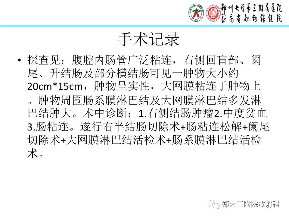 【PPT】小儿腹部伯基特Burkitt's淋巴瘤