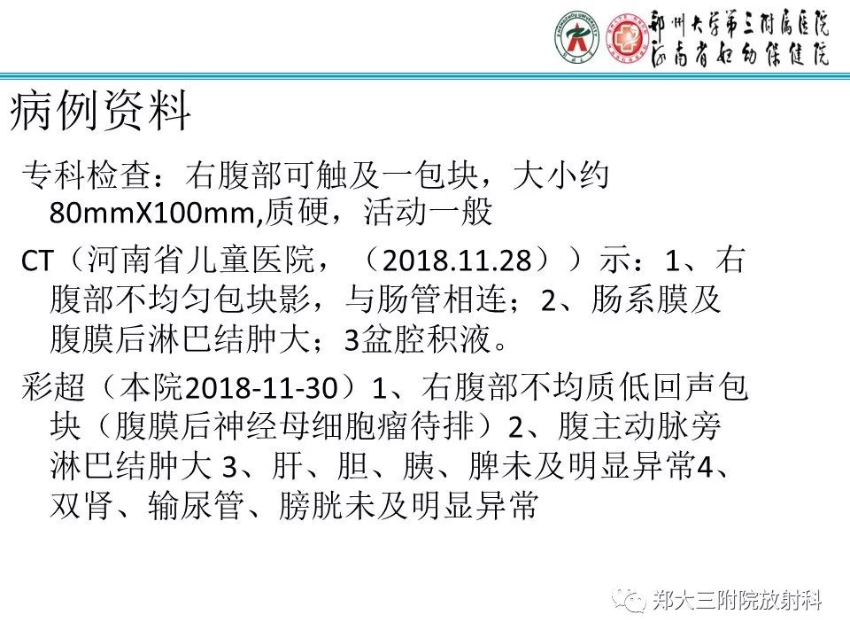 【PPT】小儿腹部伯基特Burkitt's淋巴瘤