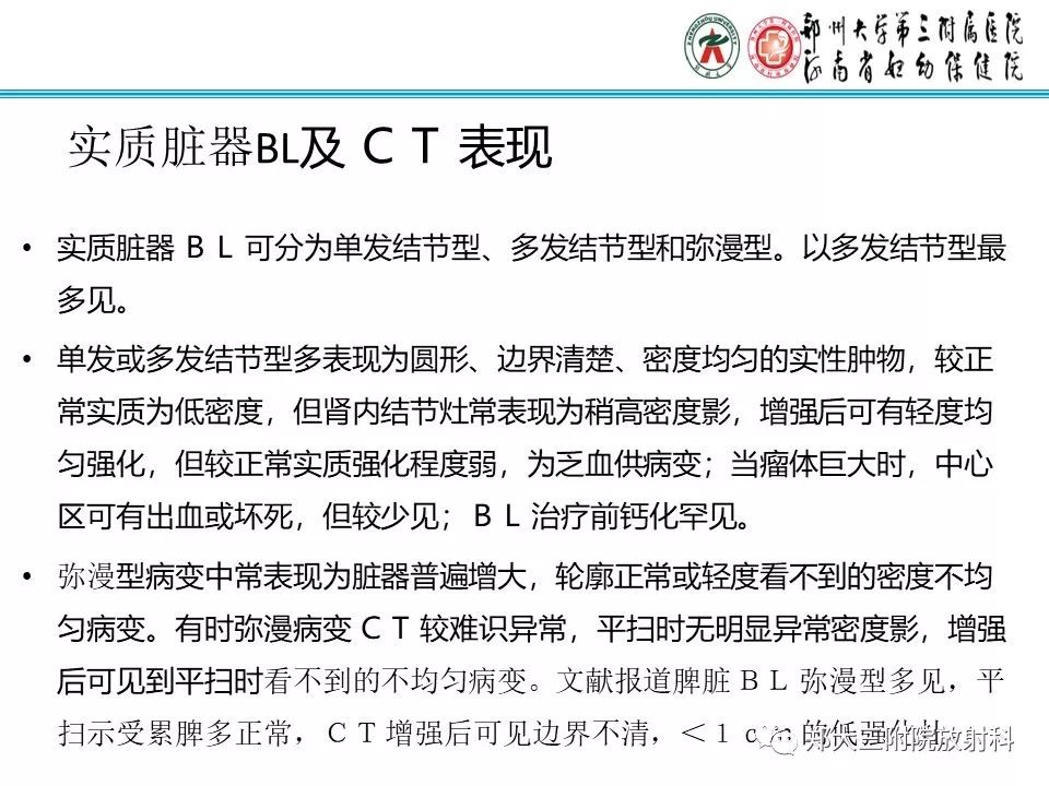 【PPT】小儿腹部伯基特Burkitt's淋巴瘤