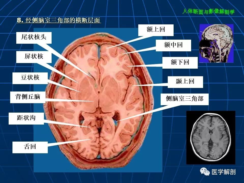 颅脑大体及磁共振断层解剖