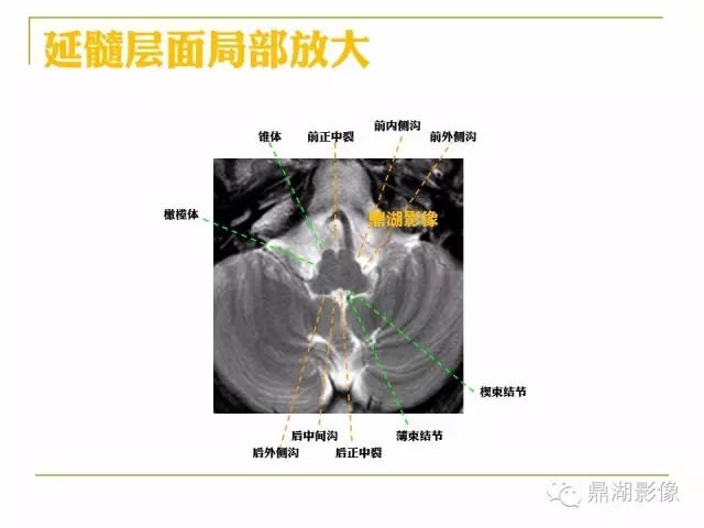 颅脑大体及磁共振断层解剖