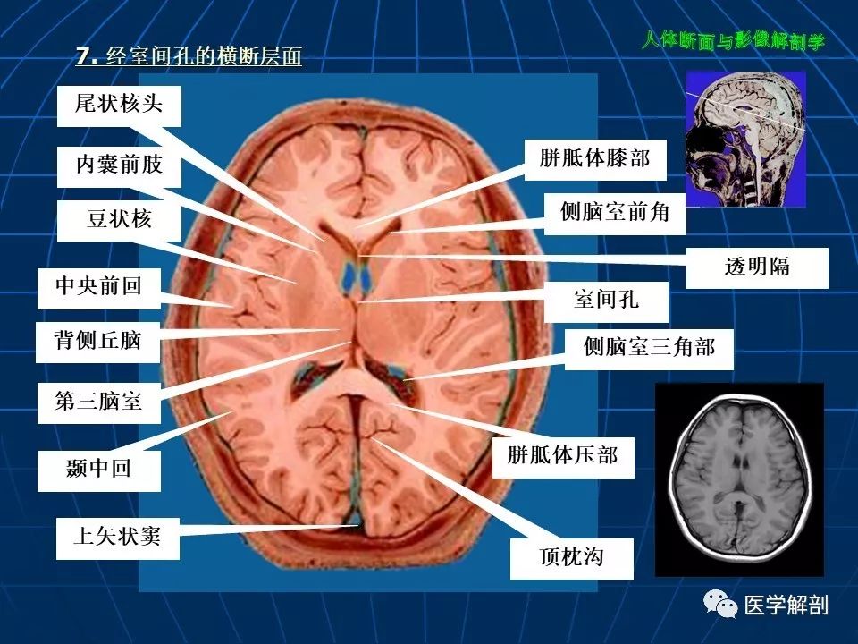 颅脑大体及磁共振断层解剖