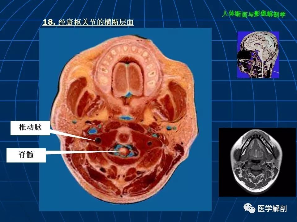 颅脑大体及磁共振断层解剖