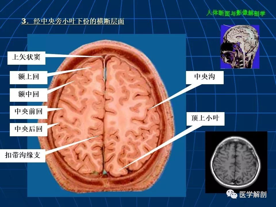颅脑大体及磁共振断层解剖