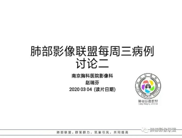 【病例】 肺白塞氏病1例CT影像讨论