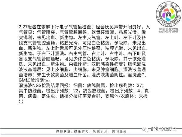 【病例】 肺白塞氏病1例CT影像讨论