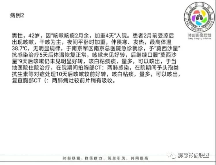 【病例】 肺白塞氏病1例CT影像讨论