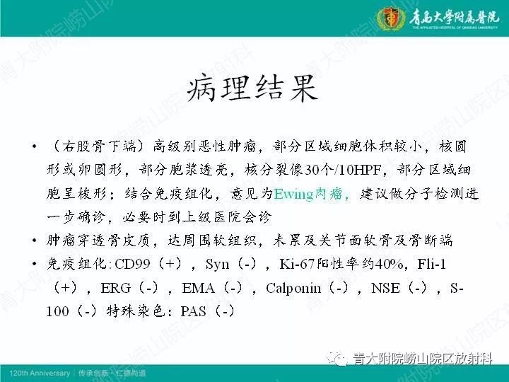 【病例】股骨尤文肉瘤1例CT及MR影像