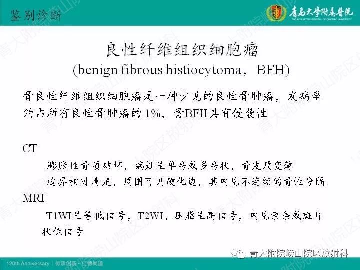 【病例】股骨尤文肉瘤1例CT及MR影像