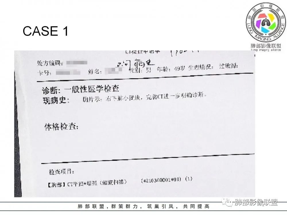【病例】肺隐球菌病2例CT影像讨论