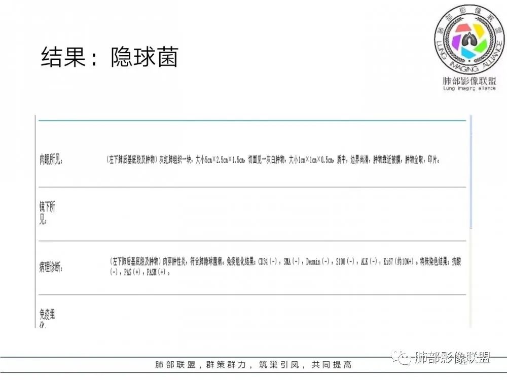 【病例】肺隐球菌病2例CT影像讨论