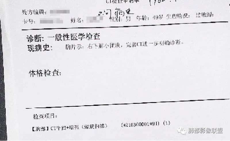 【病例】肺隐球菌病2例CT影像讨论