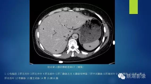 腹部CT超全断层解剖