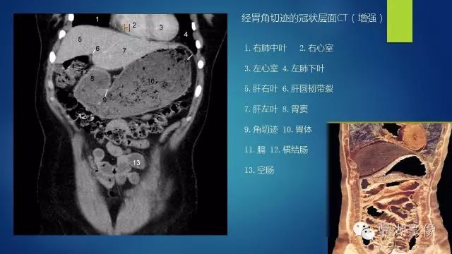 腹部CT超全断层解剖