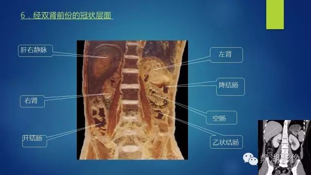 腹部CT超全断层解剖
