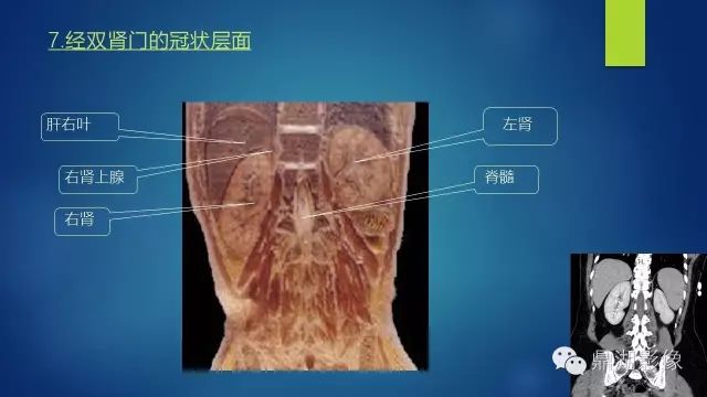 腹部CT超全断层解剖