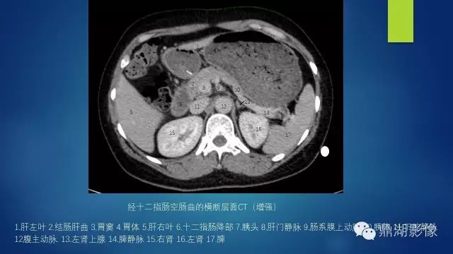 腹部CT超全断层解剖