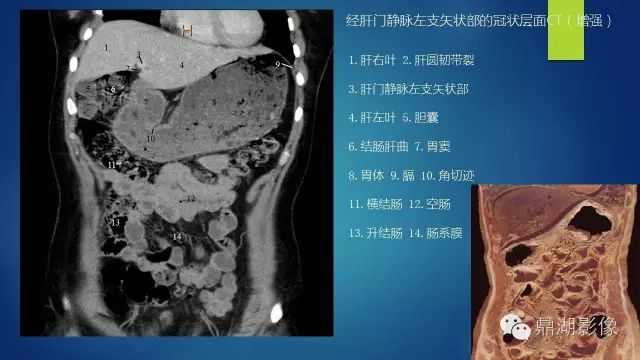 腹部CT超全断层解剖