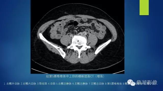 腹部CT超全断层解剖