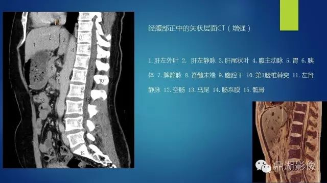 腹部CT超全断层解剖