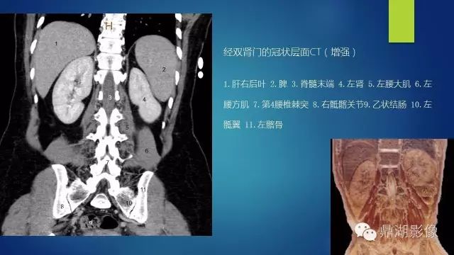 腹部CT超全断层解剖