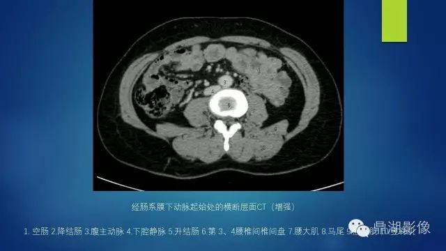 腹部CT超全断层解剖