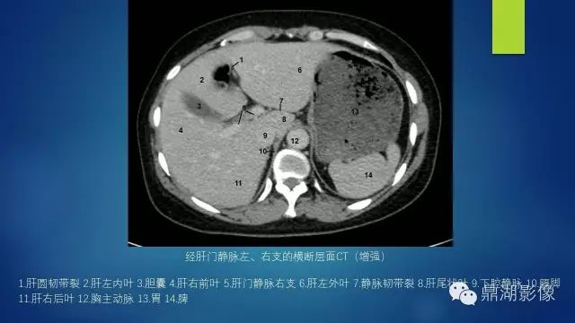 腹部CT超全断层解剖