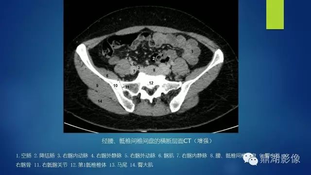 腹部CT超全断层解剖