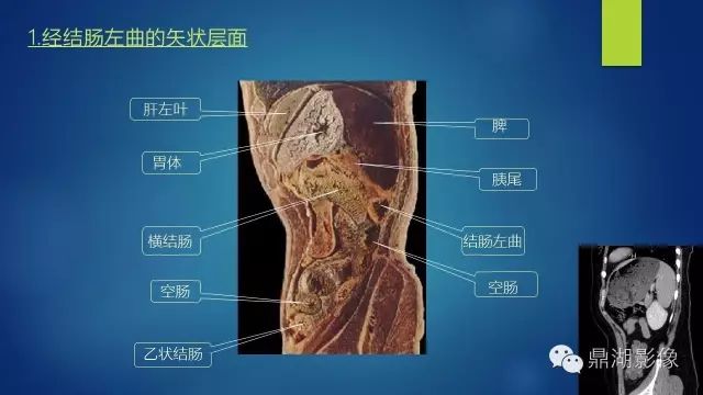 腹部CT超全断层解剖