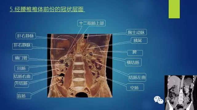 腹部CT超全断层解剖