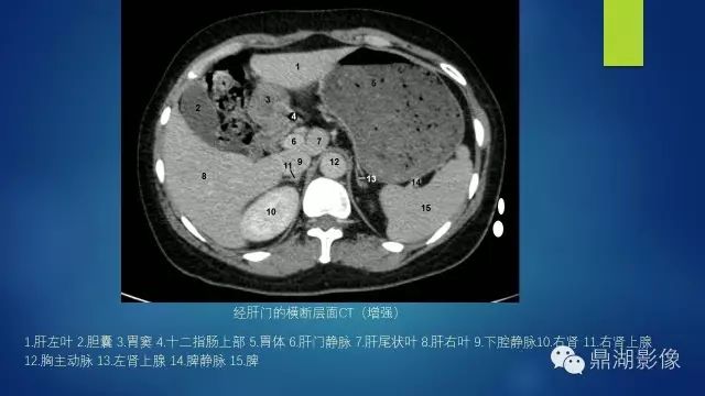 腹部CT超全断层解剖