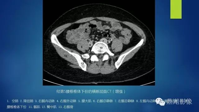 腹部CT超全断层解剖