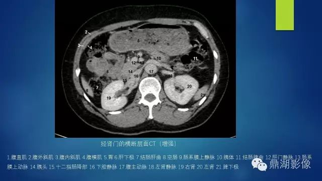 腹部CT超全断层解剖