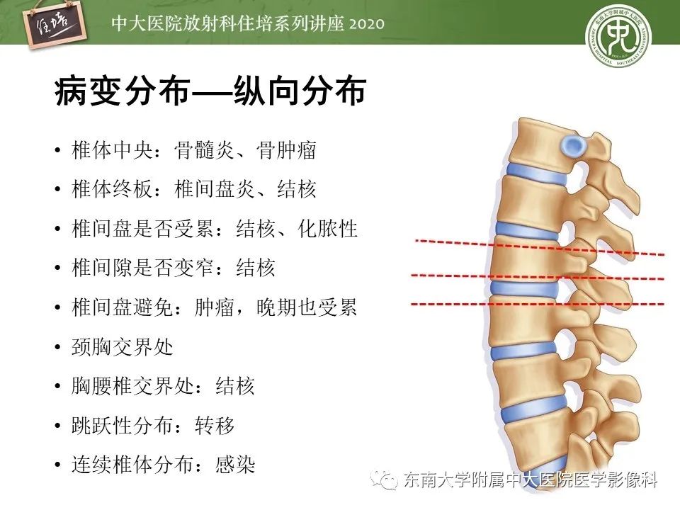 【PPT】脊柱骨源性病变影像分析思路及应用