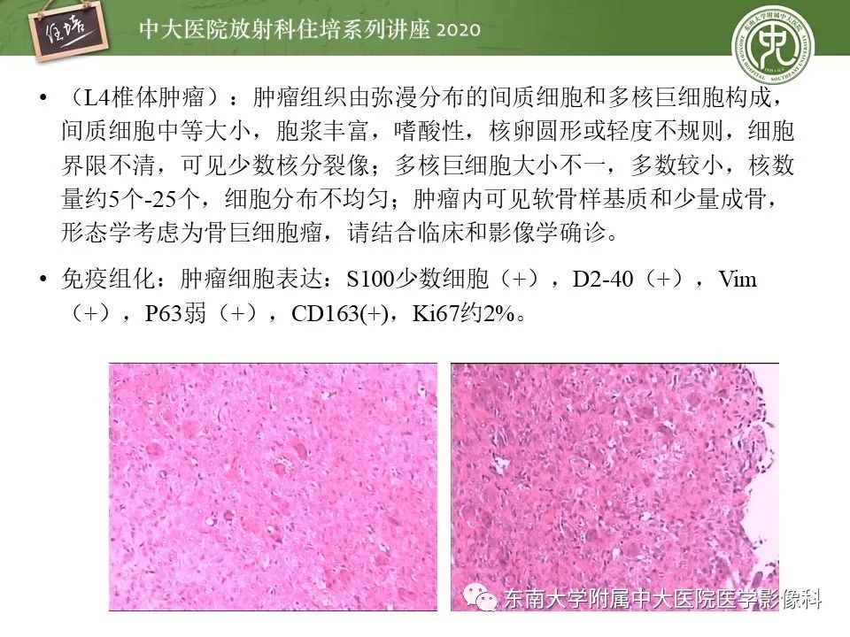 【PPT】脊柱骨源性病变影像分析思路及应用