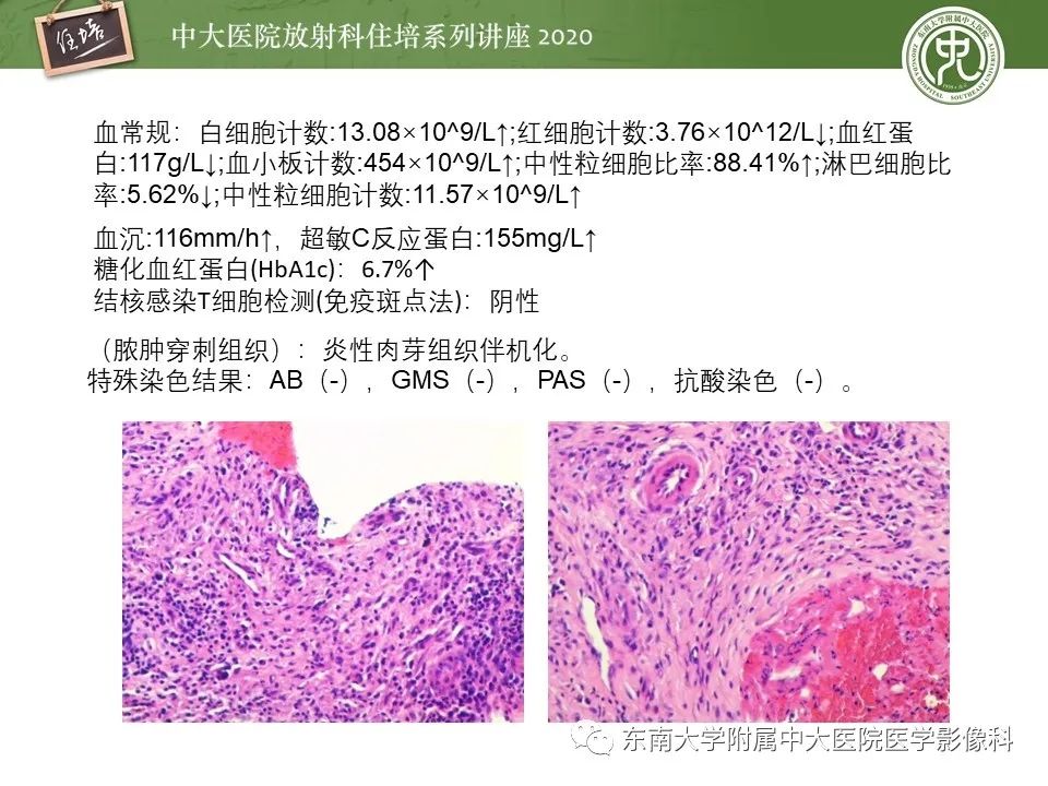 【PPT】脊柱骨源性病变影像分析思路及应用