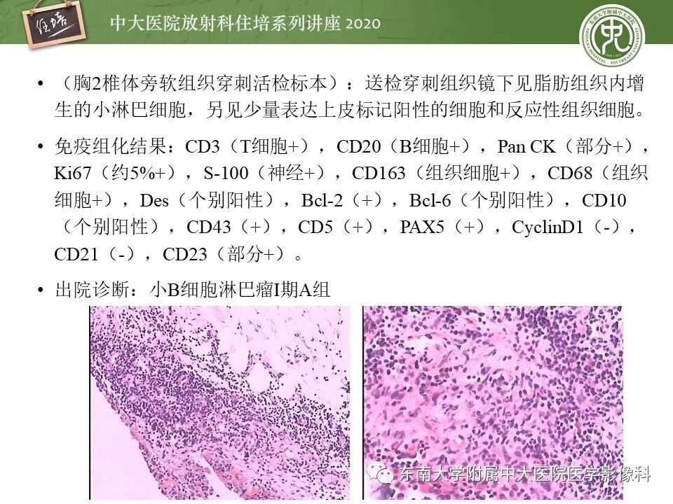 【PPT】脊柱骨源性病变影像分析思路及应用