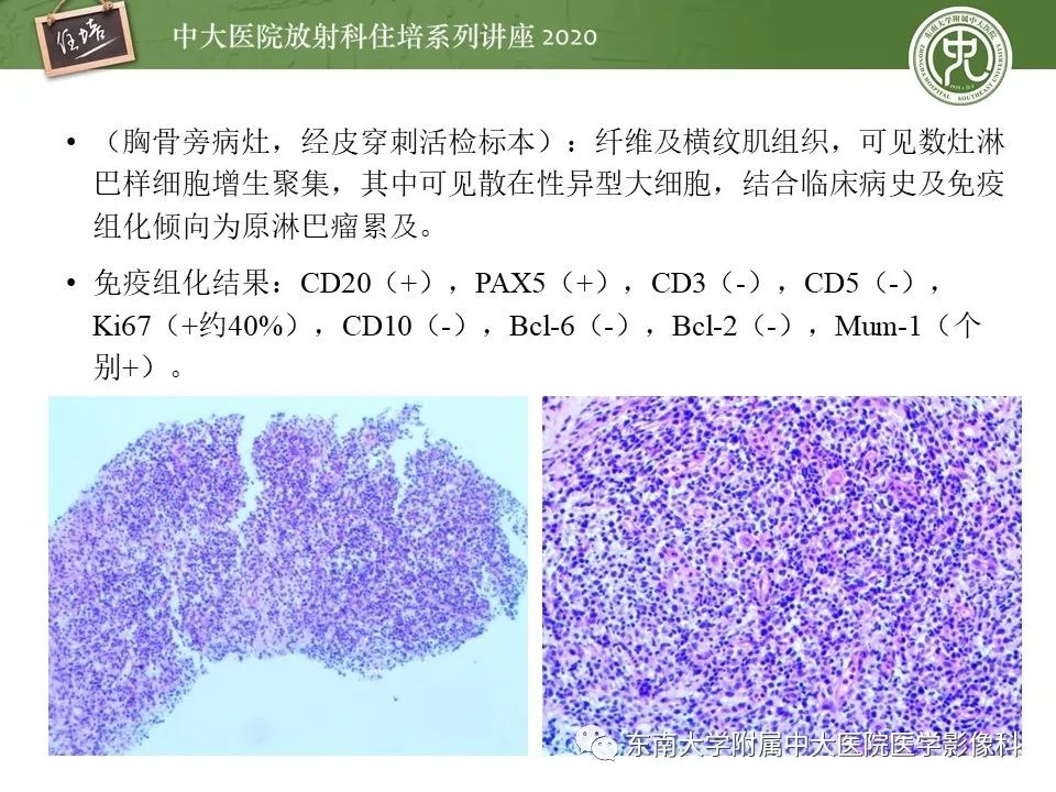 【PPT】脊柱骨源性病变影像分析思路及应用