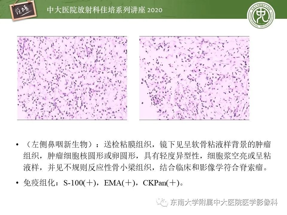 【PPT】脊柱骨源性病变影像分析思路及应用